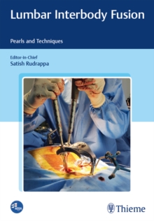 Lumbar Interbody Fusion : Pearls and Techniques