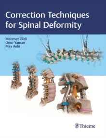 Correction Techniques for Spinal Deformity