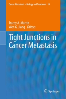 Tight Junctions in Cancer Metastasis