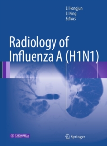 Radiology of Influenza A (H1N1)