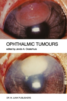 Ophthalmic Tumours : Including lectures presented at the Boerhaave Course on "Ophthalmic Tumours" of the Leiden Medical Faculty, held in Leiden, The Netherlands, on February 2-3, 1984