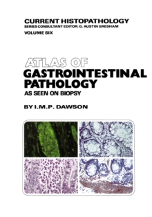 Atlas of Gastrointestinal Pathology : As Seen on Biopsy