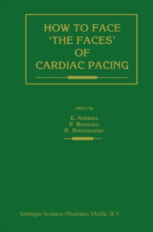 How to face 'the faces' of CARDIAC PACING