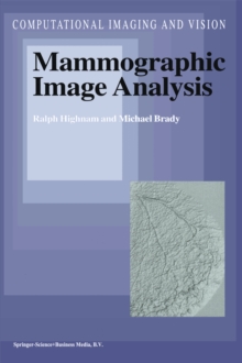 Mammographic Image Analysis