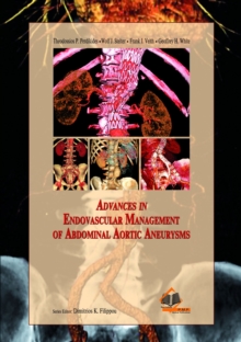 Advances in Endovascular Management of Abdominal Aortic Aneurysms, Hardback Book Advances in Endovascular Management of Abdominal Aortic Aneurysms, Hardback Book