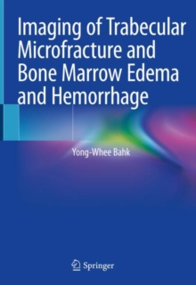 Imaging of Trabecular Microfracture and Bone Marrow Edema and Hemorrhage