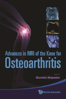 Advances In Mri Of The Knee For Osteoarthritis