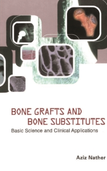 Bone Grafts And Bone Substitutes: Basic Science And Clinical Applications