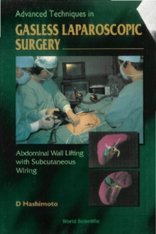 Advanced Techniques In Gasless Laparoscopic Surgery: Abdominal Wall Lifting With Subcutaneous Wiring