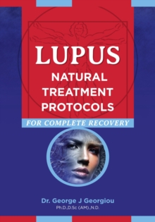 Lupus : Natural Treatment Protocols for Complete Recovery