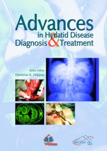 Advances in Hydatid Disease Diagnosis & Treatment, Paperback / softback Book Advances in Hydatid Disease Diagnosis & Treatment, Paperback / softback Book