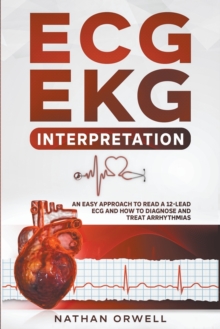 ECG/EKG Interpretation : An Easy Approach to Read a 12-Lead ECG and How to Diagnose and Treat Arrhythmias