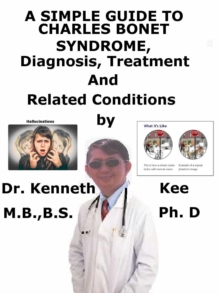 Simple Guide to Charles Bonnet Syndrome, Diagnosis, Treatment and Related Conditions