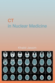 CT in Nuclear Medicine