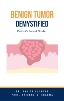 Benign Tumor Demystified: Doctor's Secret Guide