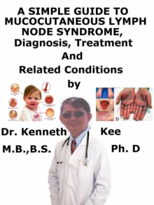 Simple Guide to Mucocutaneous Lymph Node Syndrome (Kawasaki Disease), Diagnosis, Treatment and Related Conditions