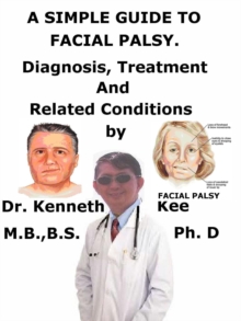 Simple Guide to Facial Palsy, Diagnosis, Treatment, and Related Conditions