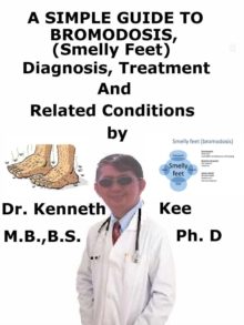 Simple Guide to Bromodosis (Smelly Feet), Diagnosis, Treatment and Related Conditions