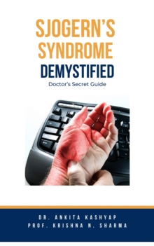 Sjogern's Syndrome Demystified Doctors Secret Guide