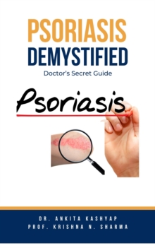 Psoriasis Demystified: Doctor's Secret Guide