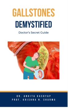 Gallstones Demystified: Doctor's Secret Guide