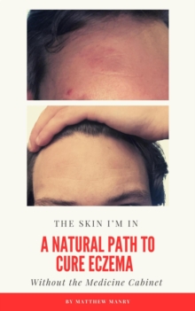 Skin I'm In: A Natural Path to Cure Eczema