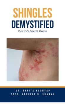 Shingles Demystified: Doctor's Secret Guide