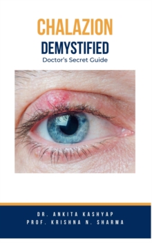 Chalazion Demystified: Doctor's Secret Guide