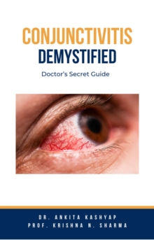 Conjunctivitis Demystified: Doctor's Secret Guide