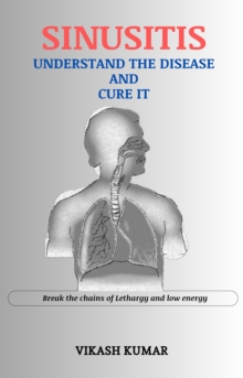 Sinusitis : Understand the disease and cure it