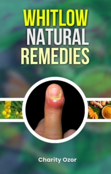 Whitlow Natural Remedies