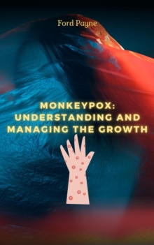 Monkeypox: Understanding And Managing The Growth