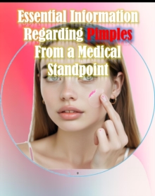 Essential information regarding pimples from a medical standpoint