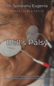 Facial Paralysis Unveiled: A Comprehensive Exploration Of Bell's Palsy