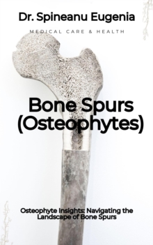 Osteophyte Insights: Navigating The Landscape Of Bone Spurs