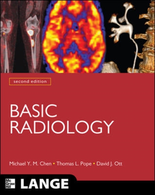 Basic Radiology, Second Edition, Paperback / softback Book