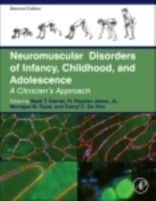 Neuromuscular Disorders of Infancy, Childhood, and Adolescence : A Clinician's Approach, Hardback Book