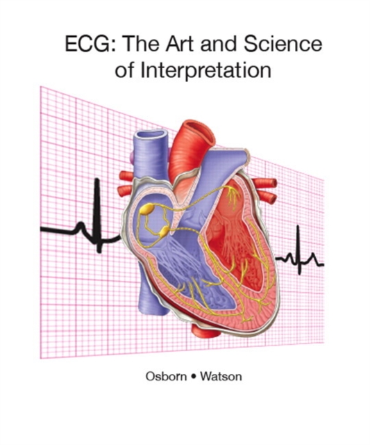 ECG : The Art and Science of Interpretation -- Instant Access, Electronic book text Book