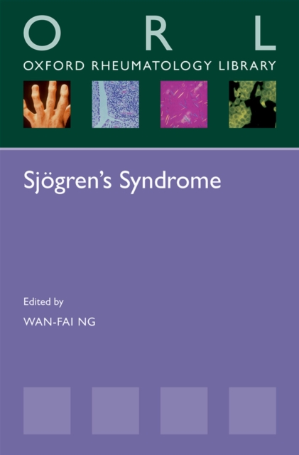 Sjogren's Syndrome, EPUB eBook