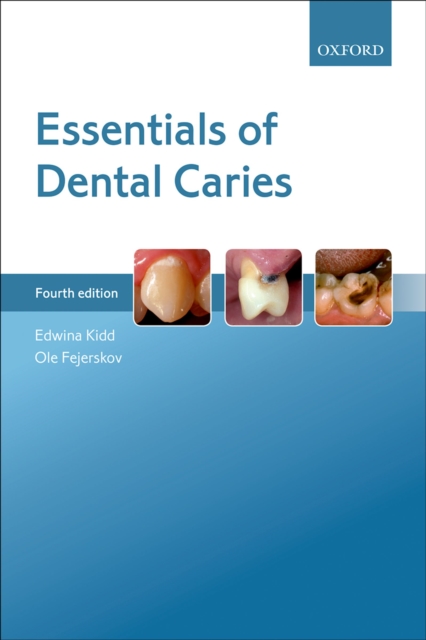 Essentials of Dental Caries, PDF eBook
