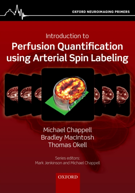 Introduction to Perfusion Quantification using Arterial Spin Labelling, PDF eBook