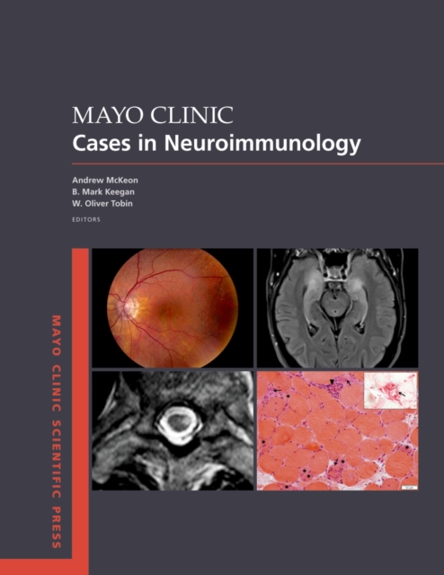 Mayo Clinic Cases in Neuroimmunology, EPUB eBook