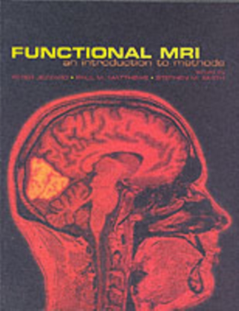 Functional Magnetic Resonance Imaging : An Introduction to Methods, Paperback / softback Book