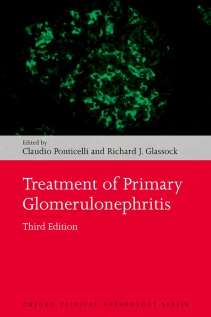 Treatment of Primary Glomerulonephritis, Paperback / softback Book