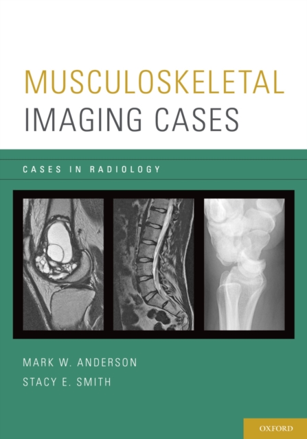 Musculoskeletal Imaging Cases, PDF eBook