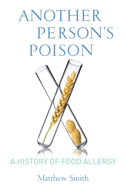 Another Person’s Poison : A History of Food Allergy, Hardback Book