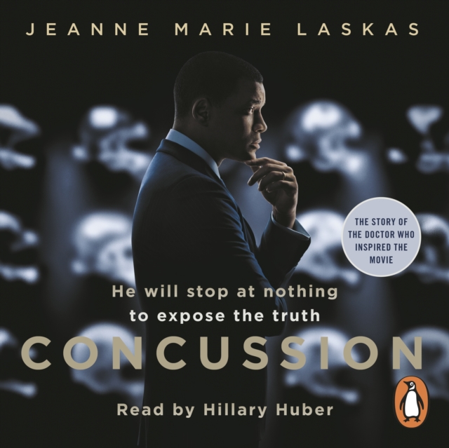Concussion, eAudiobook MP3 eaudioBook