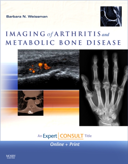 Imaging of Arthritis and Metabolic Bone Disease, Mixed media product Book