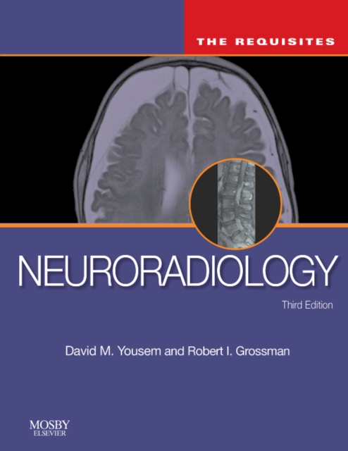 Neuroradiology: The Requisites, Hardback Book