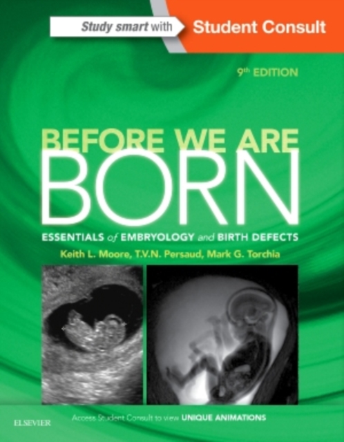 Before We Are Born : Essentials of Embryology and Birth Defects, Paperback / softback Book